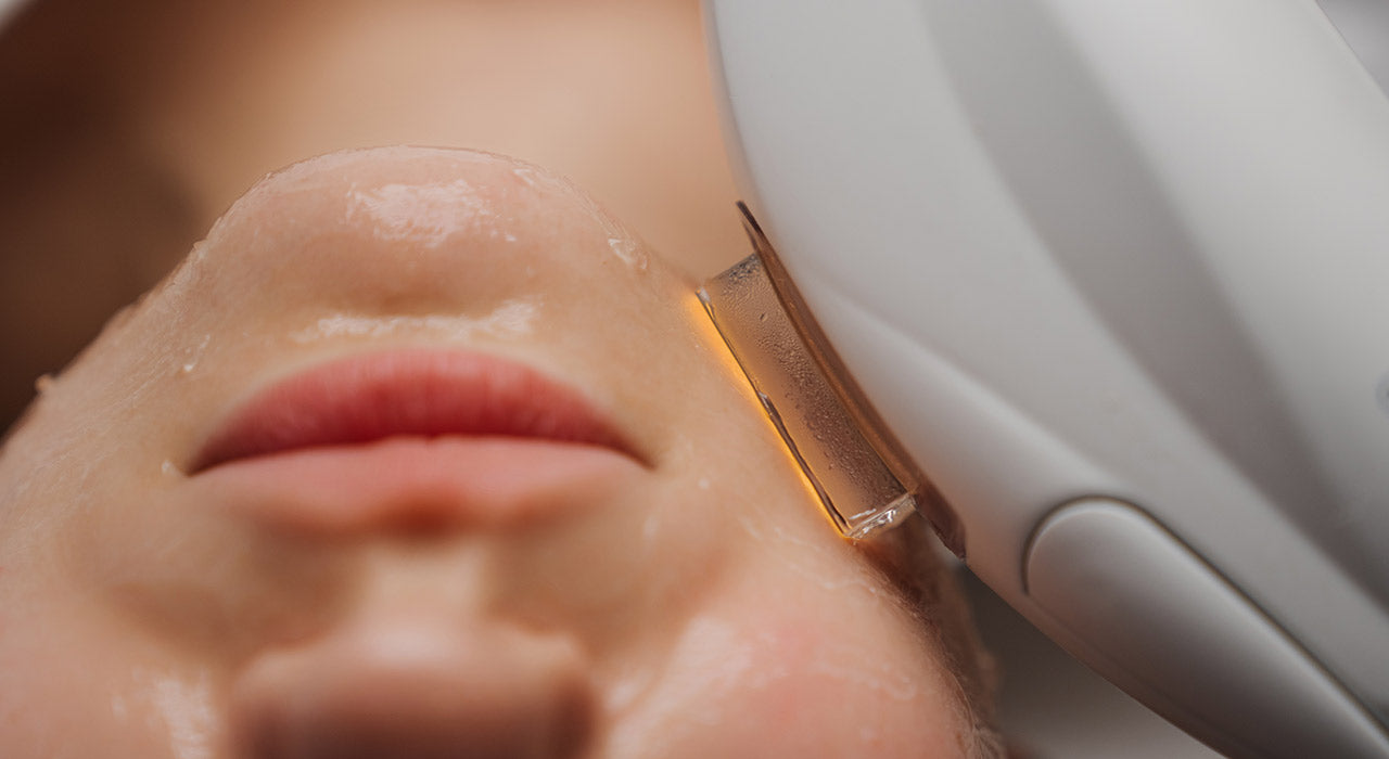 Luz Pulsada de Alta Intensidad (IPL)
