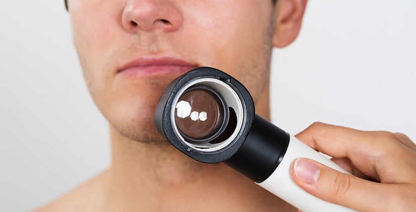 Revision corporal para detección oportuna de melanoma con fotofinder
