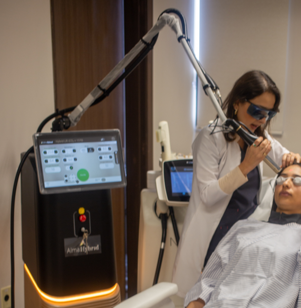 Laser Peel Hybrid