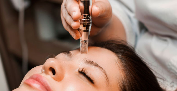 Dermapen micro needling 3 face sessions